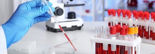 בדיקת Hepatitis A IgM Antibodies - תמונה